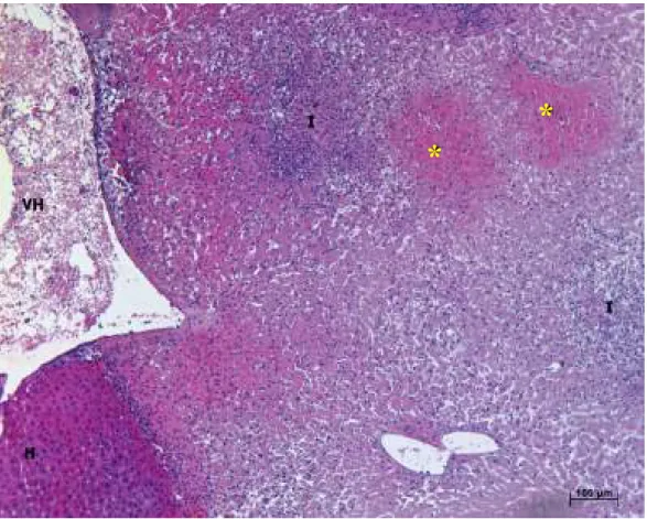 Figura  21:  Fotomicrografia  da  visão  geral  do  parênquima  hepático  mostrando  a  direita  margem com lesão necrótica e edema, contendo ilhas de hemorragia intersticial (*) e dois  grandes  focos  inflamatórios  (I)