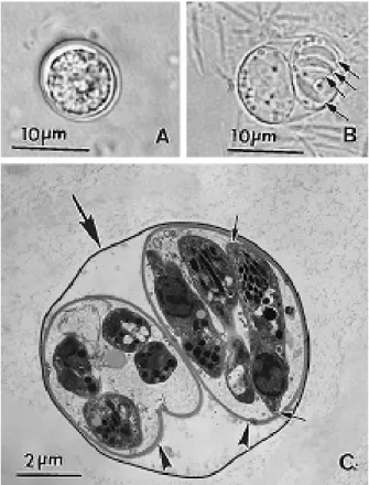 Figura 3: Oocisto de  T. gondii. (A) Oocisto não-esporulado. Massa central  (esporonte) ocupando todo o oocisto, (B) Oocisto esporulado com dois esporocistos, quatro  esporozoitos (setas) estão visíveis em um dos esporocistos, (C) Micrografia eletrônica de