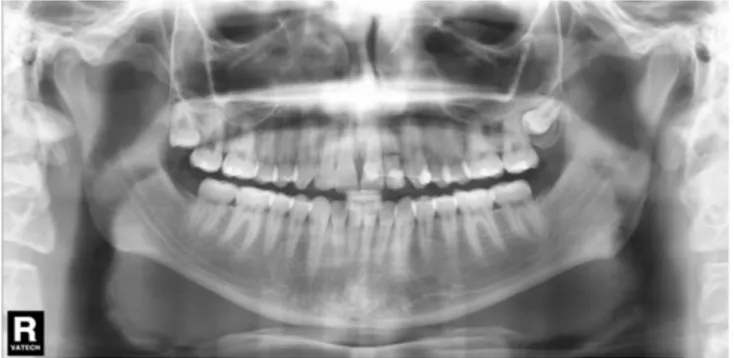 Figura 1- Radiografia Periapical 