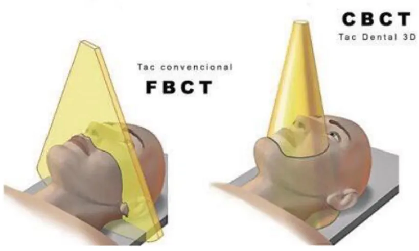 Figura 4-Comparação entre TCC e CBCT  fonte: www.clinicamanzanares.es 