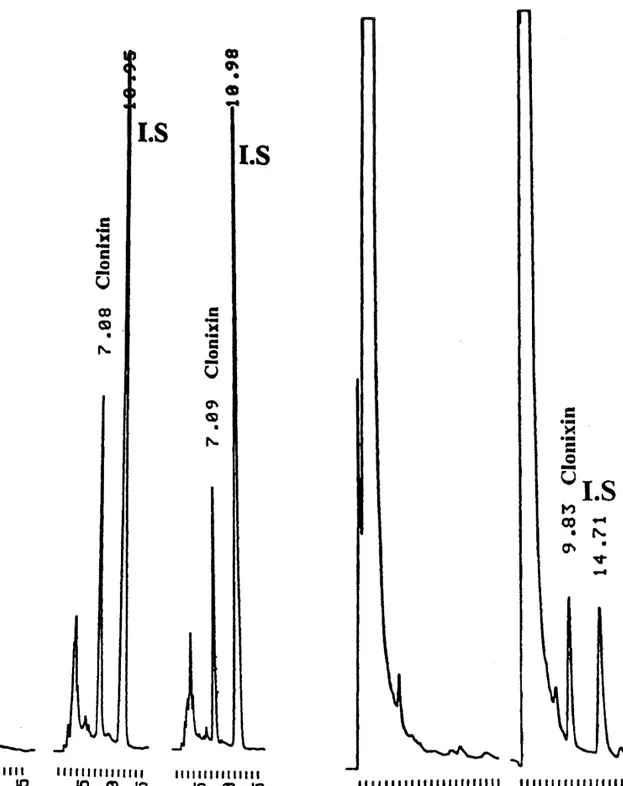 Fig. 2. Typical chromatograms of a blank plasma sample (a), a