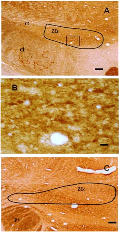 Figura 11: Fotomicrografias em campo claro de secções coronais do encéfalo do mocó,  mostrando a imunorreatividade contra PV na ZIr em A e ZIc em C