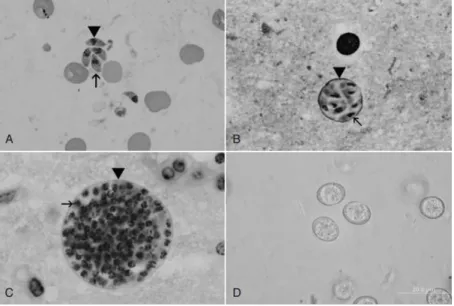 Fig. 1- Life cycle stages of T. gondii. A- Tachyzoites; B-Small tissue cysts; C- Tissue cysts; D- Unsporulated oocysts  (2)