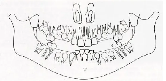 Fig. 1 – Esquema da condição oral de uma criança de 8 anos (adaptado de Barbería  Leache, E