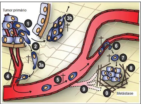 Figura 3 – A cascata  metastática. 0) Nicho pré-metastático; 1) Células  no sítio primário sob  transição  epitélio-mesenquimal  e  com  propriedades  invasivas;  2)  Degradação  da  membrana  basal e matriz extracelular (MEC); 3) Invasão de células indivi