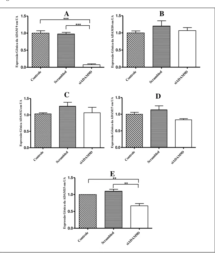 Figura 2 – Expressão do mRNA da ADAM9  (A), ADAM10 (B), ADAM12 (C) e ADAM17  (D) e ADAM15 ( E) analisada por RT-qPCR nas células MDA-MB-231