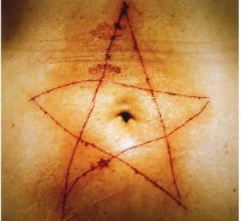 Figura 4: A estrela gravada a gilete de Marina Abramovich