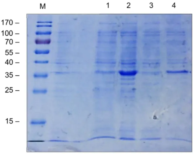 Figure 9. SDS-PAGE analysis of expression trail for CHIP protein. 