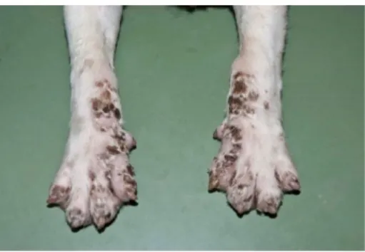Figure 1.2. Lethal acrodermatitis (9) 