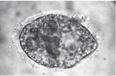 Figure 1.  Photography of Balantidium coli trophozoite found in feces of a  HIV-positive patient, with cilia (A), macronucleus C) and contractile  vacuoles (B).
