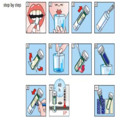 Figure  5: Step by step procedure  CTR bacteria  by Ivoclar  Vivadent  ® -
