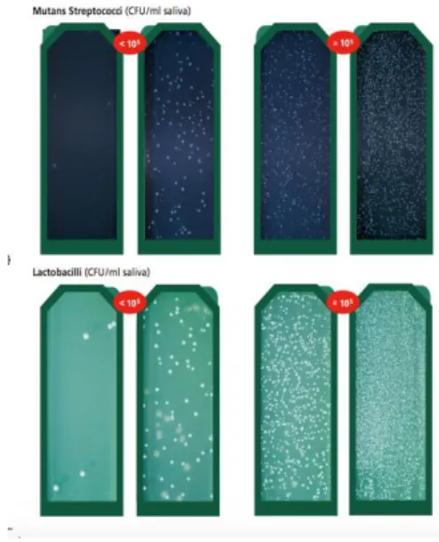 Figure  6: Interpretation  picture  of  the number  of S.Mutans  and Lactobacilli  by Ivoclar  Vivadent  ® - 