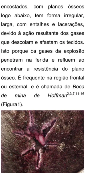 Figura  1.  Boca  de  mina  de  Hoffmann. 