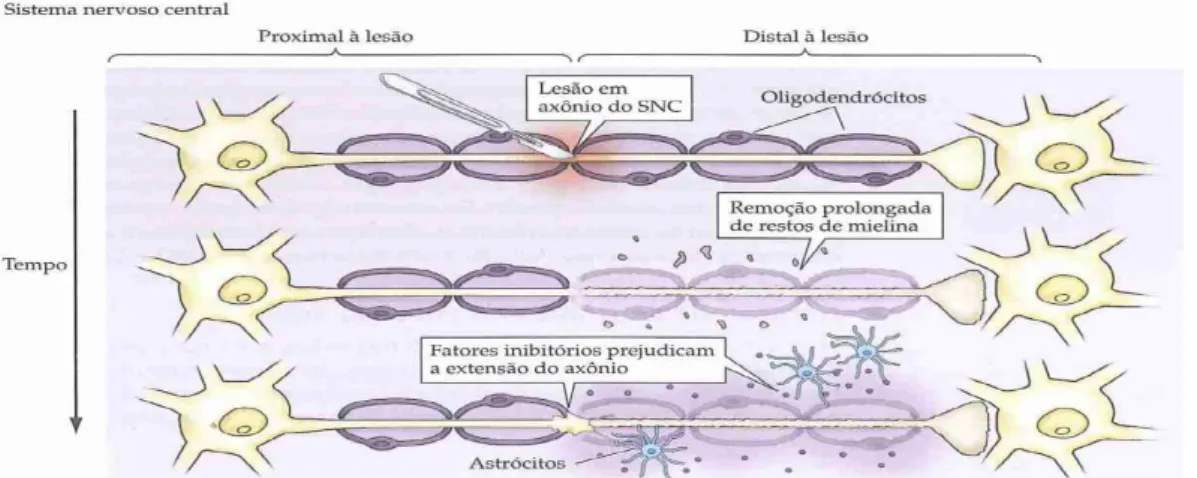 Figura 7. Esquema da resposta à lesão nos axónios do SNC (fonte: Purves, et alii., 2005) (1)