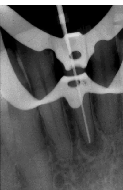 Figura 9: Rx de Comprimento de Trabalho (Gordon, 2004)