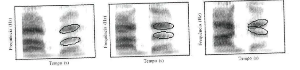 Fig. 23: Espectrogramas de banda larga das sequências sonoras aba, ada e aga, respectivamente