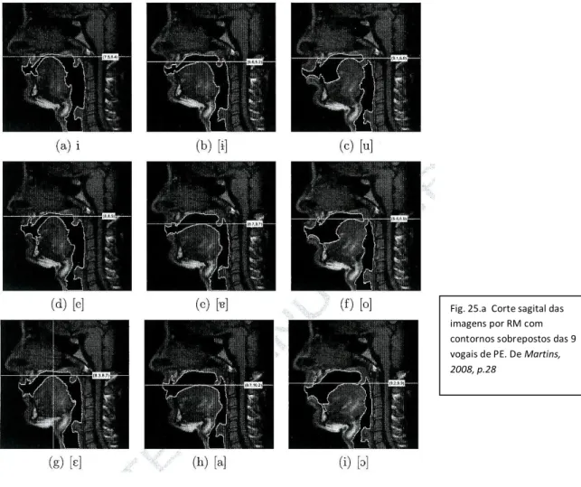 Fig. 25.a  Corte sagital das  imagens por RM com  contornos sobrepostos das 9  vogais de PE