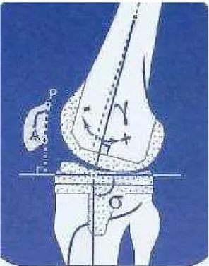 FIGURA 4 - Desenho do desvio femoral (γ) e da inclinação  tibial  (σ)  medidos  no  pós-operatório  na  incidência  em  perfil
