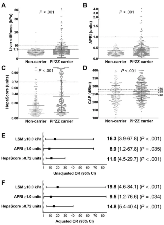 Figure 3. Non-invasive liver ﬁ brosis and steatosis parameters in carriers homozygous for the AAT Pi*Z variant (Pi*ZZ) and Pi*Z non-carriers