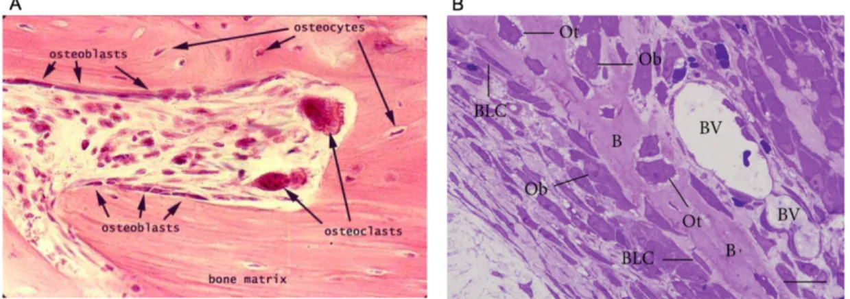 Figure 2 – Micrographs of bone portions. A – On this histological image, osteoblasts are visible on the  surface of the bone matrix, together with giant osteoclasts