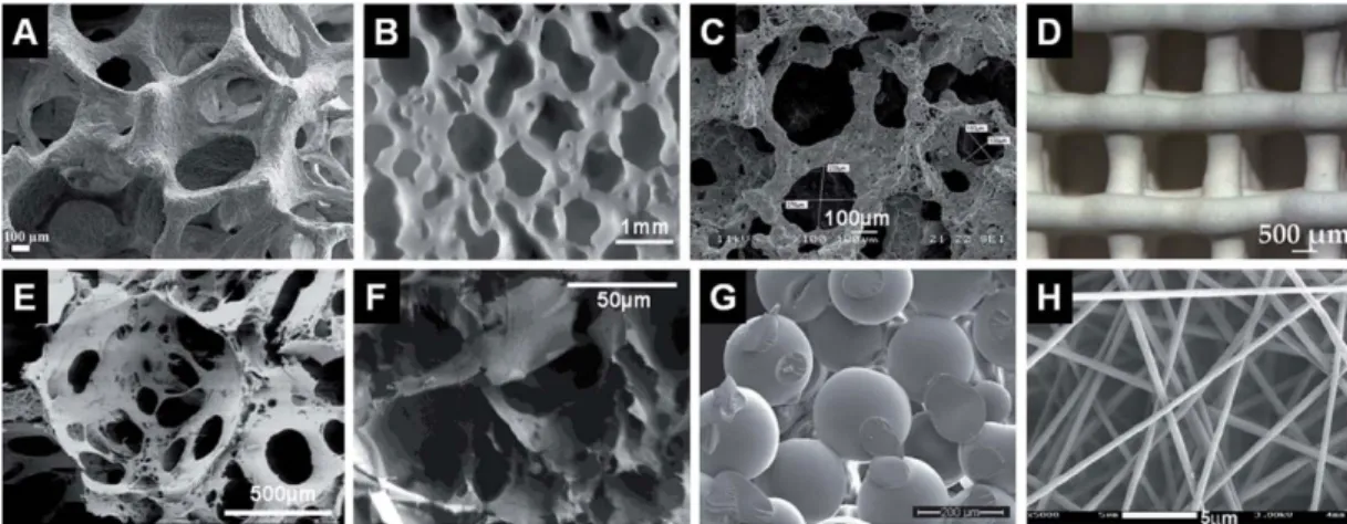 Figure 7 – Different types of porous scaffolds used in BTE. Representative internal structures of porous  scaffolds produced via (A) polymer sponge replication, (B) impregnate sintering, (C) gel-cast foaming, (D)  solid  free-form  fabrication,  (E)  solve