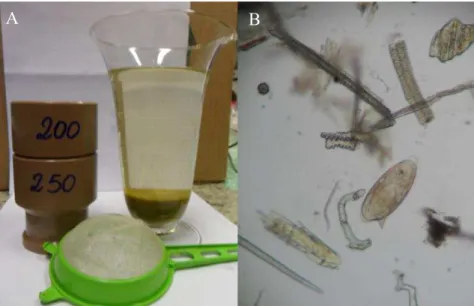 Figura 7: Exame parasitológico de fezes pela técnica de Girão e Ueno (1982) para detecção de  ovos  de  Schistosoma  mansoni