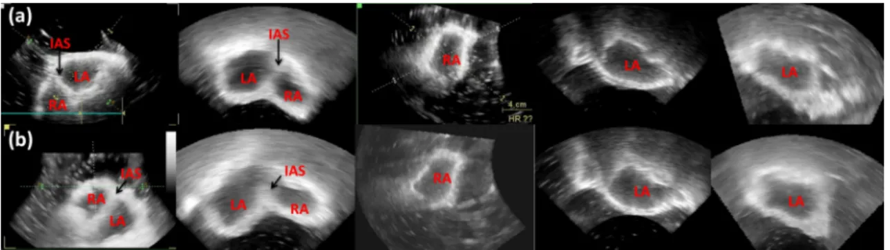 Figure 9 - Resulting ultrasound image for (a) silicone-based and (b) PVA-C-based phantom