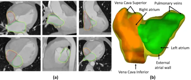 Figure 2 - Manual delineation strategy. a) Multiple 2D slices; and b) 3D representation of the atrial shape