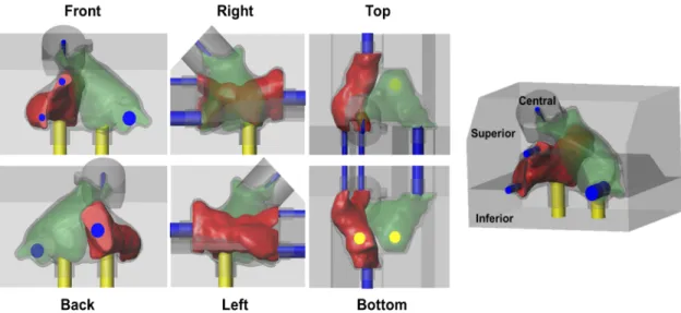 Figure 4 – Illustration of the assembled 3D printed-molds. Red and green are the inner molds of the right atrium and  left atrium, respectively