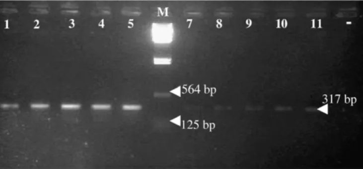 Fig. 1. Sensitivity of PCR applied to the extracted DNA. Lanes 1–5 Prosorhynchus aculeatus; Lane 6 (M): DNA/HindIII-23130pb marker; Lanes 7–11 P