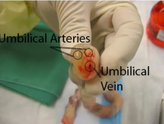 Figure  2.3.  GD2  antigen expression  in  MSCs  from three  different sources:  WJ  (A), umbilical  cord vein (B)  and  umbilical cord arteries (C) [7]