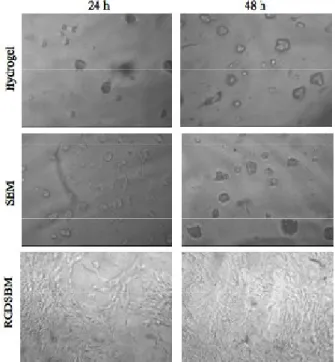 Figure 2.13. Microscopic analysis of the fibroblasts cultivated on Dex hydrogels without recombinant proteins,  coated  with  a  starch-binding  molecule  (SBM),  and  coated  with  a  starch-binding  molecule  and  a  RGD  sequence  (RGDSBM) with differen