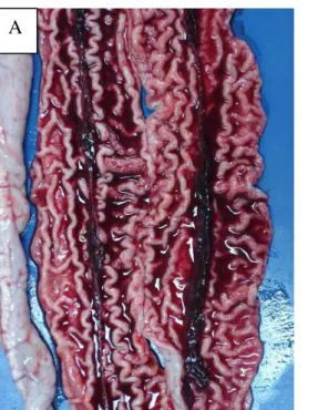 Figura  1.2:  Intestino  delgado.  (A)  Enteropatia  proliferativa  hemorrágica.  Observar  mucosa  espessada e presença de sangue e coágulo no lúmen