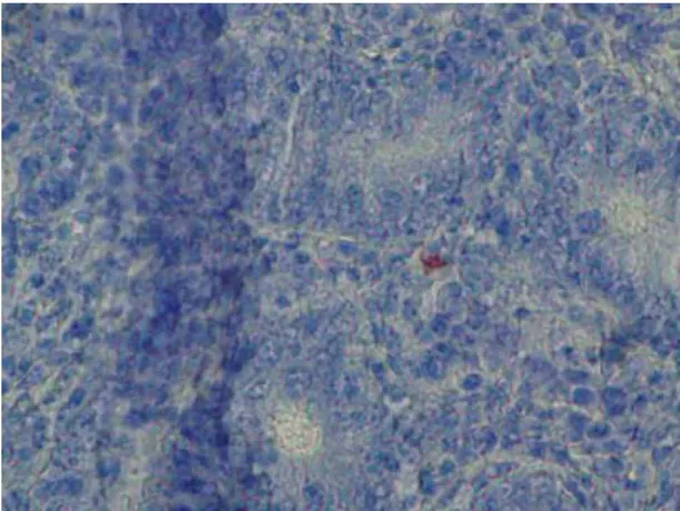 Figura 2.5: Microfotografia de íleo de Pardal, experimentalmente inoculado, corada pela técnica  de  IHQ  com  anticorpos  específicos  para  L