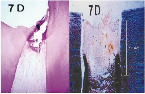 Figura 6. Imagem histológica de um dente, após 7 dias da colocação de hidróxido de cálcio, exibindo  uma  camada  necrótica  de  1.5  mm,  formada  enquanto  resultado  do  seu  alto  pH