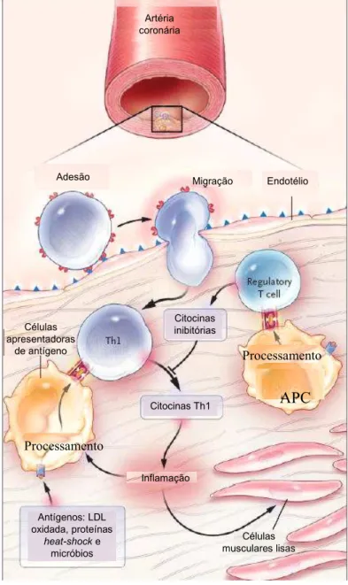 Figura 6: Efeito das células T ativadas na inflamação da placa aterosclerótica.   