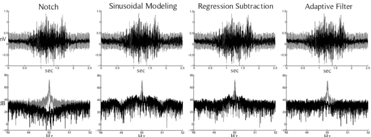 Figure 2.8: Removal of PLN from sEMG signal using different digital filters. Top row: raw and filtered signals, bottom row: frequency spectrum [47].