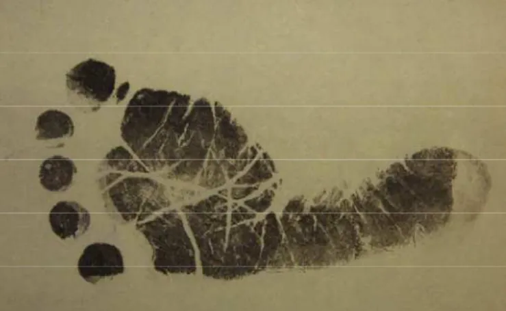 Figura 4. Impressão plantar de um recém-nascido executada com tinta preta. 