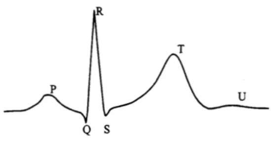 Figure 3.3: ECG wave