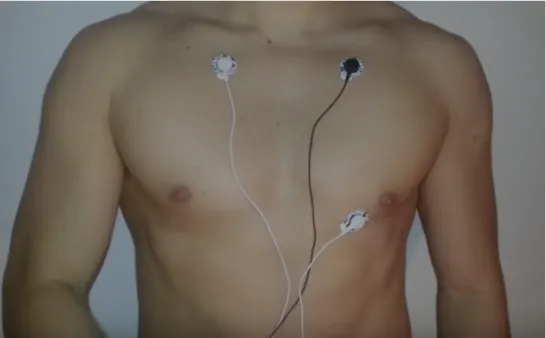 Figure 4.1: ECG electrodes connected to chest