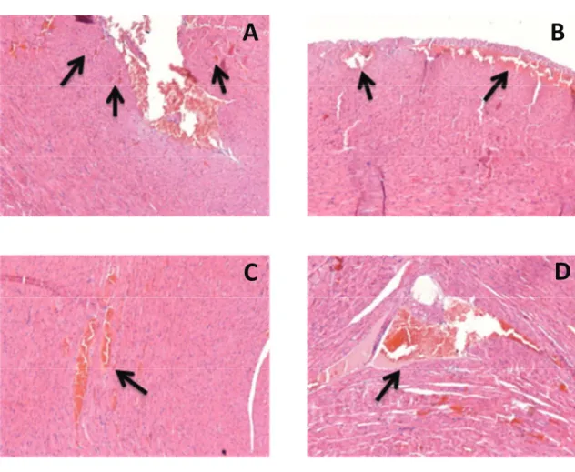 FIGURA 7C – Cortes histológicos de ventrículos esquerdos de corações de ratos adultos que  receberam durante 10 dias administrações repetidas de testosterona (10 mg/kg) e cocaína (20  mg/kg)