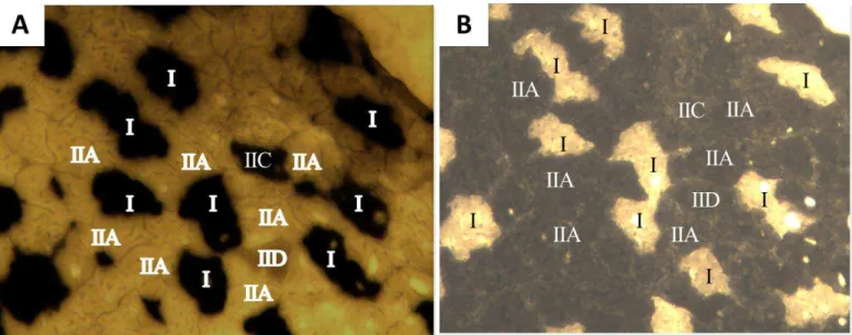 Figura 4 - Coloração histoenzimológica do músculo plantar (figura 4.A: mATPase  pH 4.1 e figura 4.B: mATPase pH 9.4)