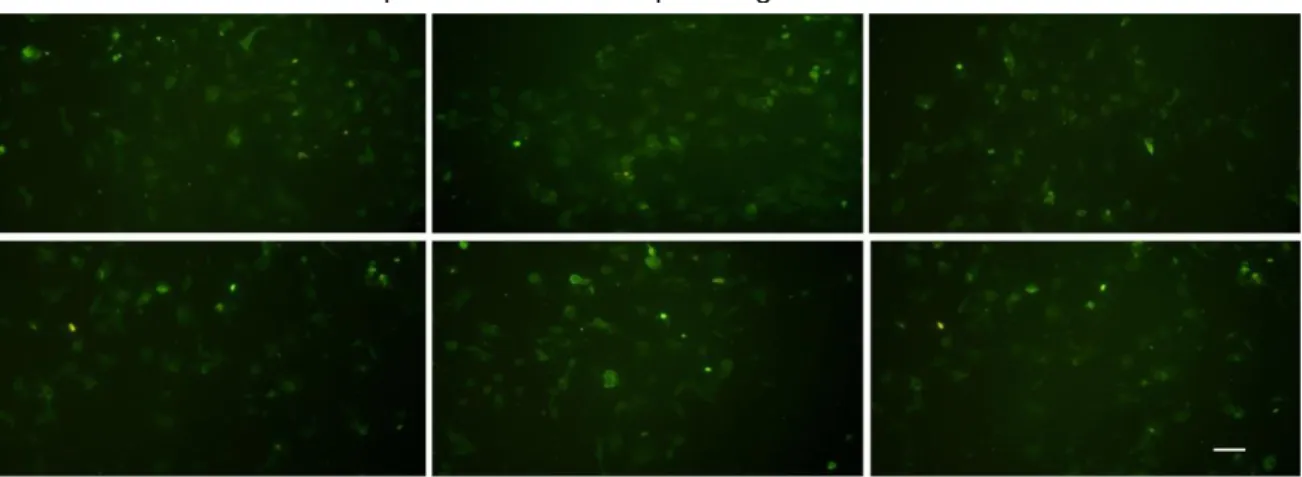 Figura 1 -  Micrografia de fluorescência mostrando a presença da proteína desmina em todas as  células