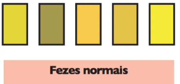 FIGURA  3 - Escala cromática das fezes, estabelece as  cores  de fezes  normais e as  suspeitas em relação à presença de colestase neonatal.