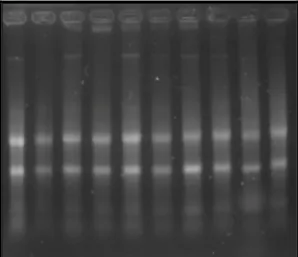 FIGURA  08.  Exemplo  de  um  gel  de  agarose  (1,5%)  corado  com brometo de  etídio indicando a  integridade  do RNA total,  através da visualização das bandas ribossomais 28S e 18S