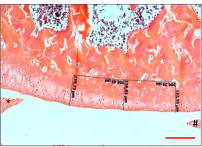 Figura 5: Fotomicrografia de um campo do  côndilo medial do fêmur localizado entre  os  cornos  anterior  e  posterior  do  menisco  medial  -  Lâmina  corada  com  H&amp;E  pertencente a um dos animais do grupo lesão 8 semanas - Representa como foi realiz