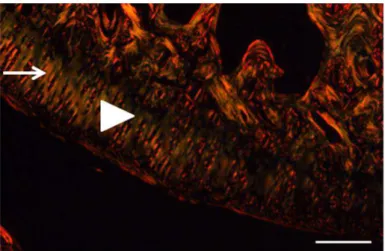 Figura  6:  Fotomicrografia  de  um  campo  do    côndilo  medial  do  fêmur  localizado  próximo  ao  corno  anterior  do  menisco  medial  -  Lâmina  corada  com  Picro  Sirius  Red  para  análise  de  birrefringência  do  colágeno  pertencente  o  a  um