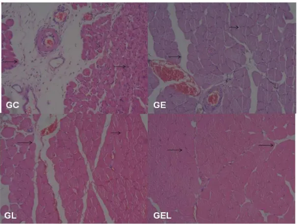 Figura 14: Análise morfológica da região lesada no músculo TAD do Grupo A. O GC  mostra  núcleos  centralizados,  maior  infiltrado  inflamatório,  maior  presença  de  tecido  conjuntivo  e  desorganização  fascicular