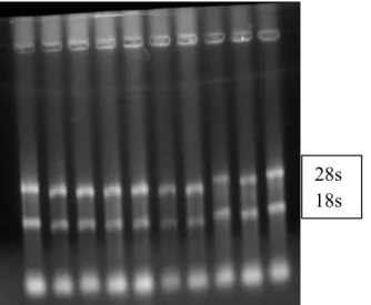 Figura 1. Exemplo de um gel de agarose (1%) corado com brometo de etídeo indicando a  integridade do RNA totais, através da visualização das bandas ribossomais 18s e 28s
