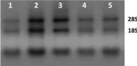 Figura 7.  Padrão eletroforético das subunidades 18S e 28S do rRNA em gel de  agarose 1% corado com brometo de etídio